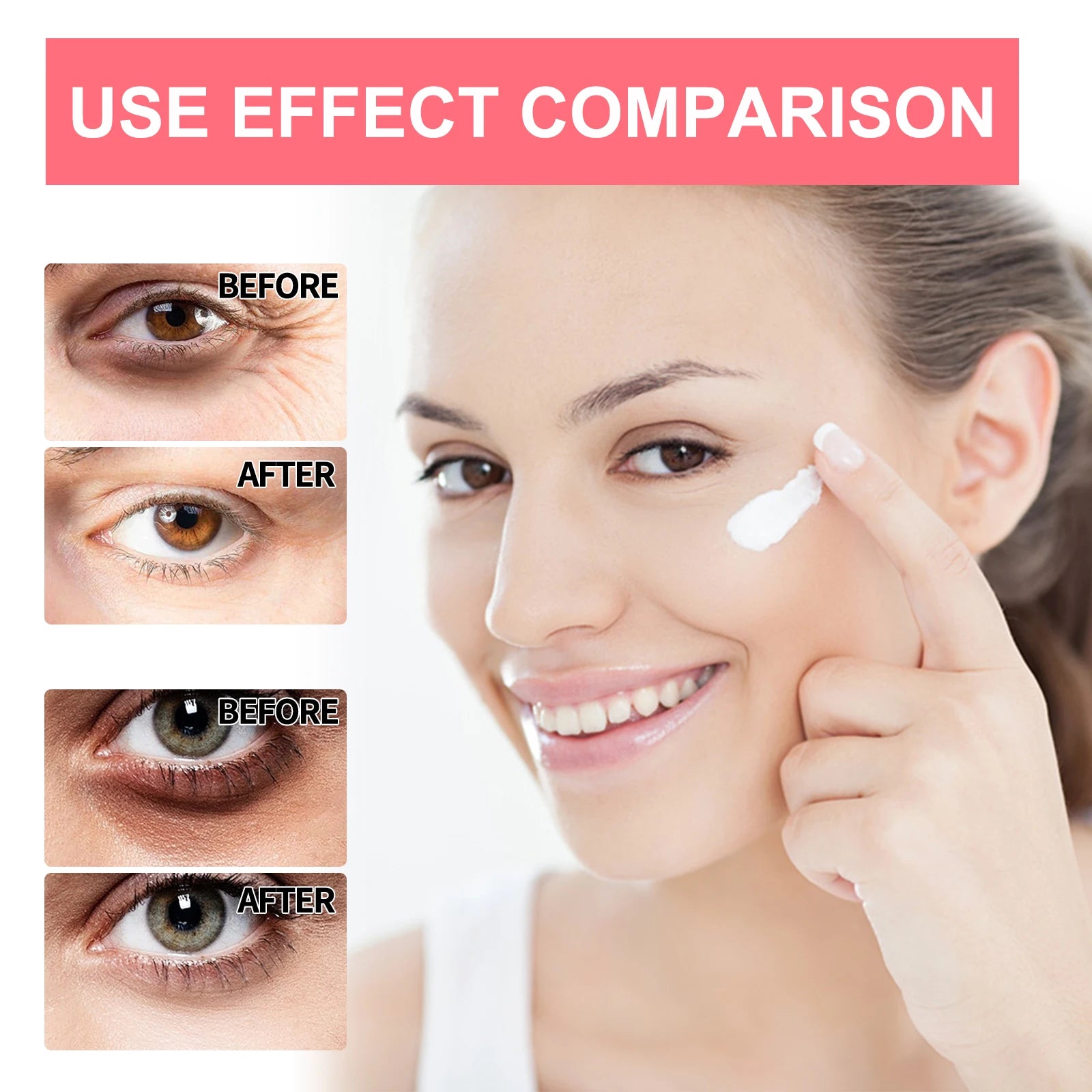 See the Difference Around Your Eyes